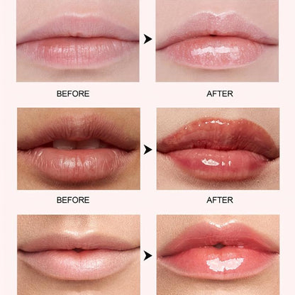 Orasub™ | Lip Plumper