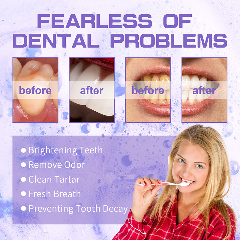 orabus™ Purple Whitening Toothpaste | With just one brushing, effortlessly neutralize yellow teeth and reveal a bright, white smile.