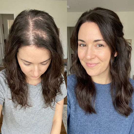 10-Second Hair Concealer Cover Grays. Fill Thin Areas. Perfect Your Hairline.