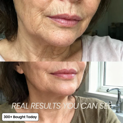 Up to 60% OFF Orasub PDRN Pink Collagen Volume Multi Balm
