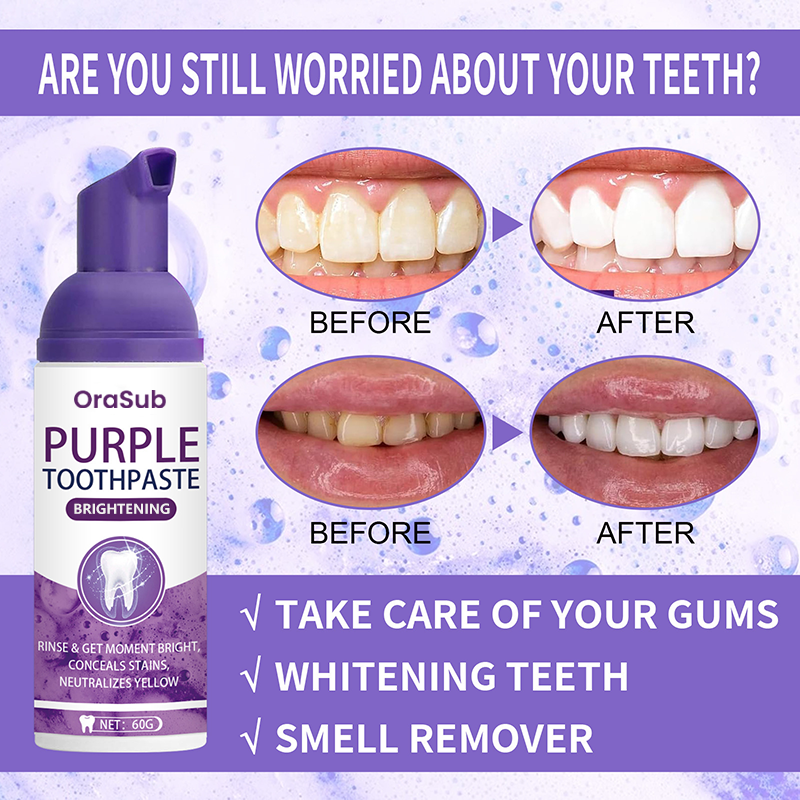orabus™ Purple Whitening Toothpaste | With just one brushing, effortlessly neutralize yellow teeth and reveal a bright, white smile.