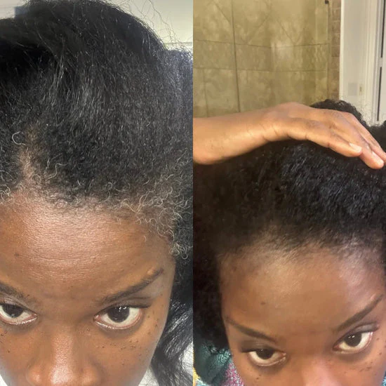 10-Second Hair Concealer Cover Grays. Fill Thin Areas. Perfect Your Hairline.
