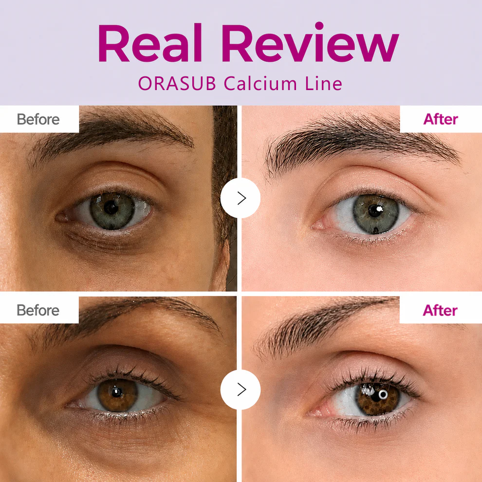 🔥LAST DAY 60% OFF!!ORASUB Korean Calcium Dark Spot Eye Cream